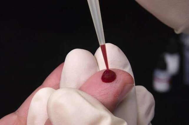 взятие крови для анализа на паразитов 